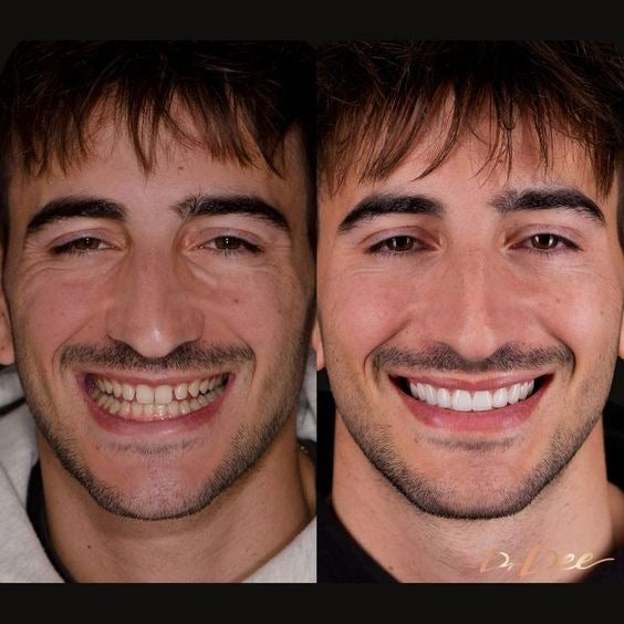 Marvis Whitening Mint Freshen Breath and Remove Smoke Stains Toothpaste